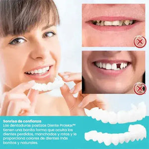 DIENTE PROMAX - CARILLAS DENTALES - OFERTA 2X1 SOLO POR HOY!